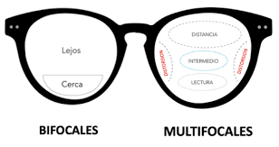 Tipos de corrección visual disponibles